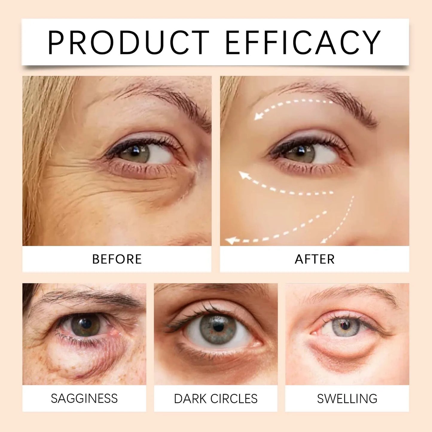 5D Peptide Eye Cream – Dark Circles, Wrinkles & Puffiness