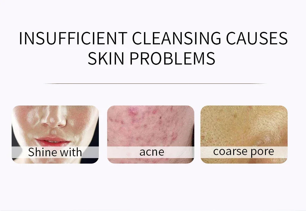 ENVISHA Exfoliating Mousse Peeling Gel – Deep Cleanse & Pore Refining 120ml Face Cleanser Peaceful Pleasures Health and Wellness
