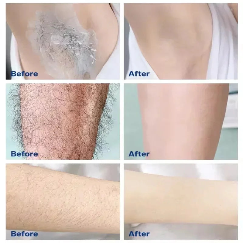Collagen Hair Removal Cream – Fast Depilatory for Men & Women