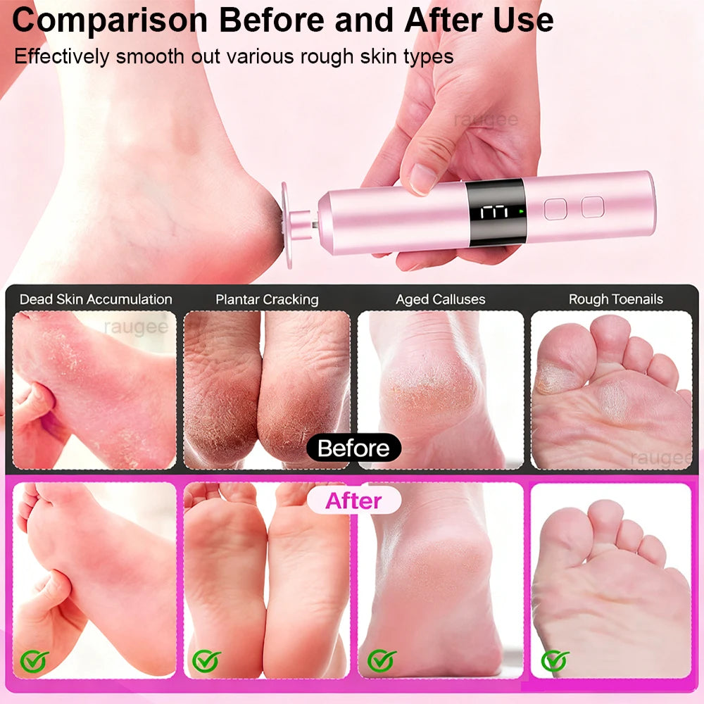 Electric Foot Grinder Callus Remover Foot Exfoliation Sander Electric Foot File Pedicure Machine for Feet Foot Dead Skin Remover Peaceful Pleasures Health and Wellness