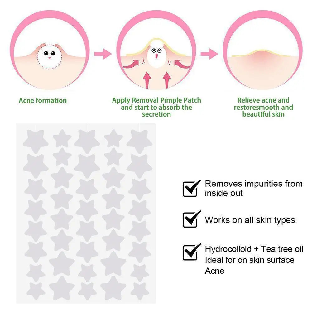 40-Pack Star-Shaped Pimple Cover Patches | Colorful & Cute