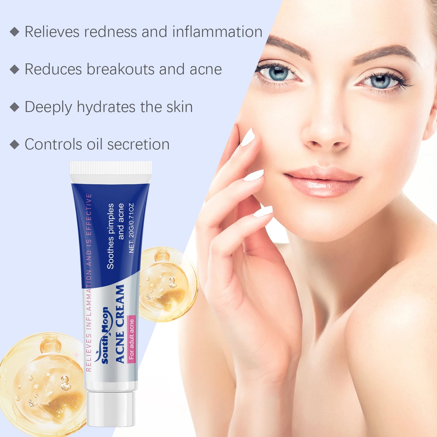 South Moon Anti-Acne Cream – Oil Control & Pore Minimizer 20g