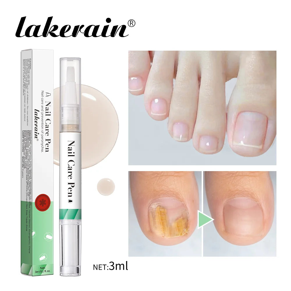 Nail Care Pen Nourish and Moisturize Nails Prevent Fungal Infections Improve Appearance Flat Brush Head Design Daily Nail Care Peaceful Pleasures Health and Wellness Green