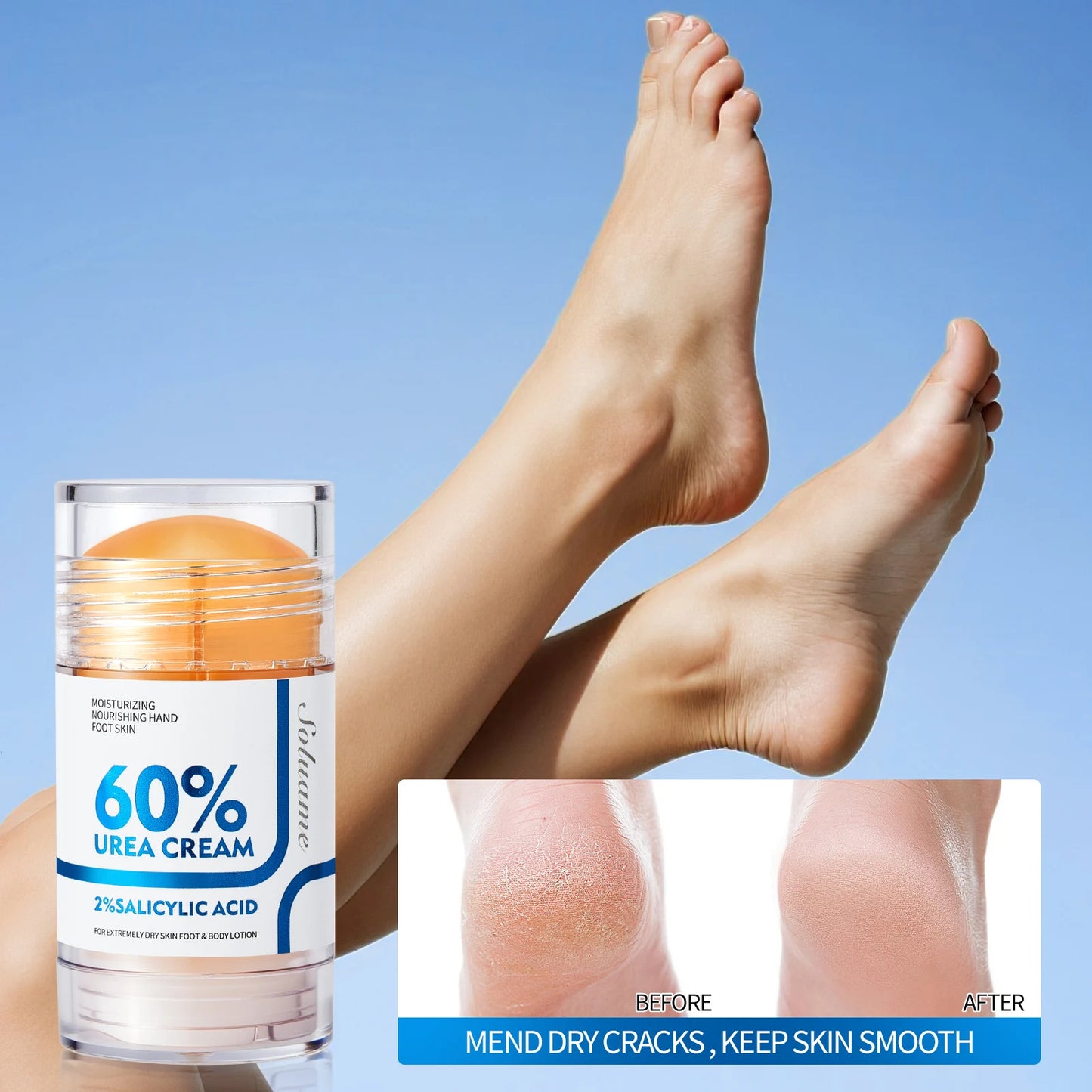 Urea Foot Cream for Dry Cracked Feet and Hands Peaceful Pleasures Health and Wellness