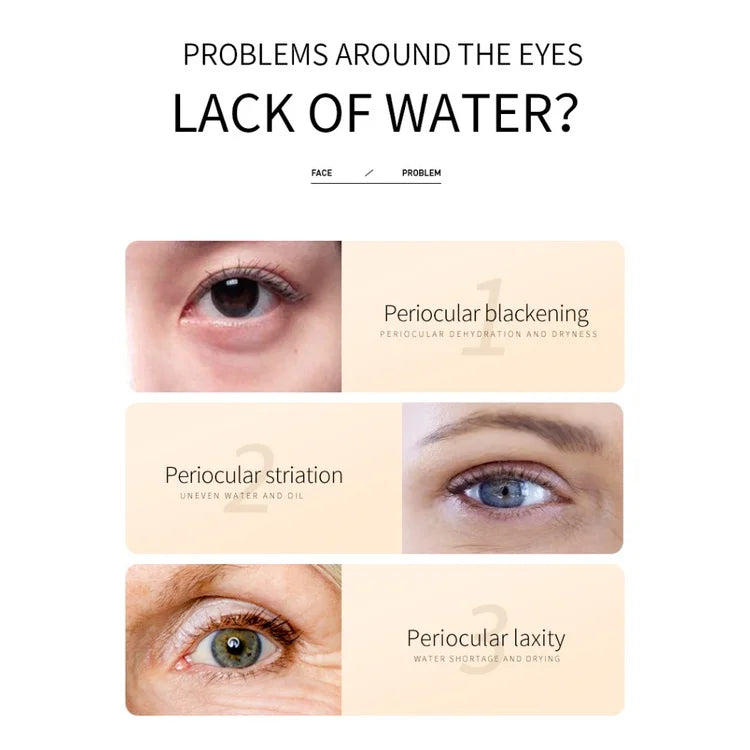 BIOAOUA Rice Whitening Eye Cream Moisturizing Reduce Dark Circles Lift Firm Brightening 20g Peaceful Pleasures Health and Wellness