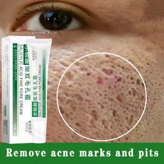 Pore Shrinking Cream Elimination Large Pores Blackehead Remove Acne Pit Repair Gel Tighten Face Smooth Skin Korean Care Products Peaceful Pleasures Health and Wellness Default Title