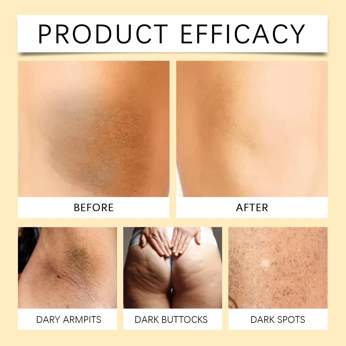 Vitamin E Capsules – Dark Spot Corrector & Skin Brightening Serum