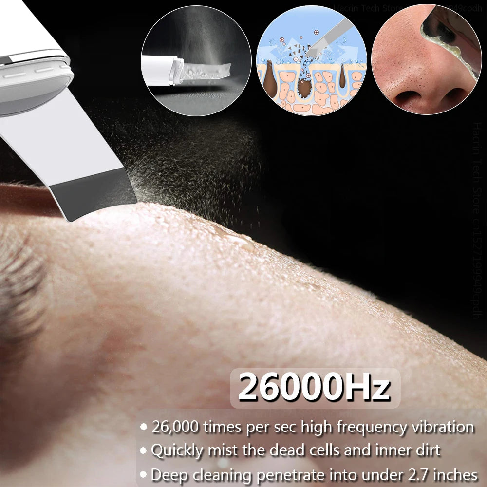 Ultrasonic Face Scrubber Facial Peeling Skin Scrubber Deep Facial Cleaning Spatula Acne Pore Ultrasonic Scrubber Facial Cleanser Peaceful Pleasures Health and Wellness