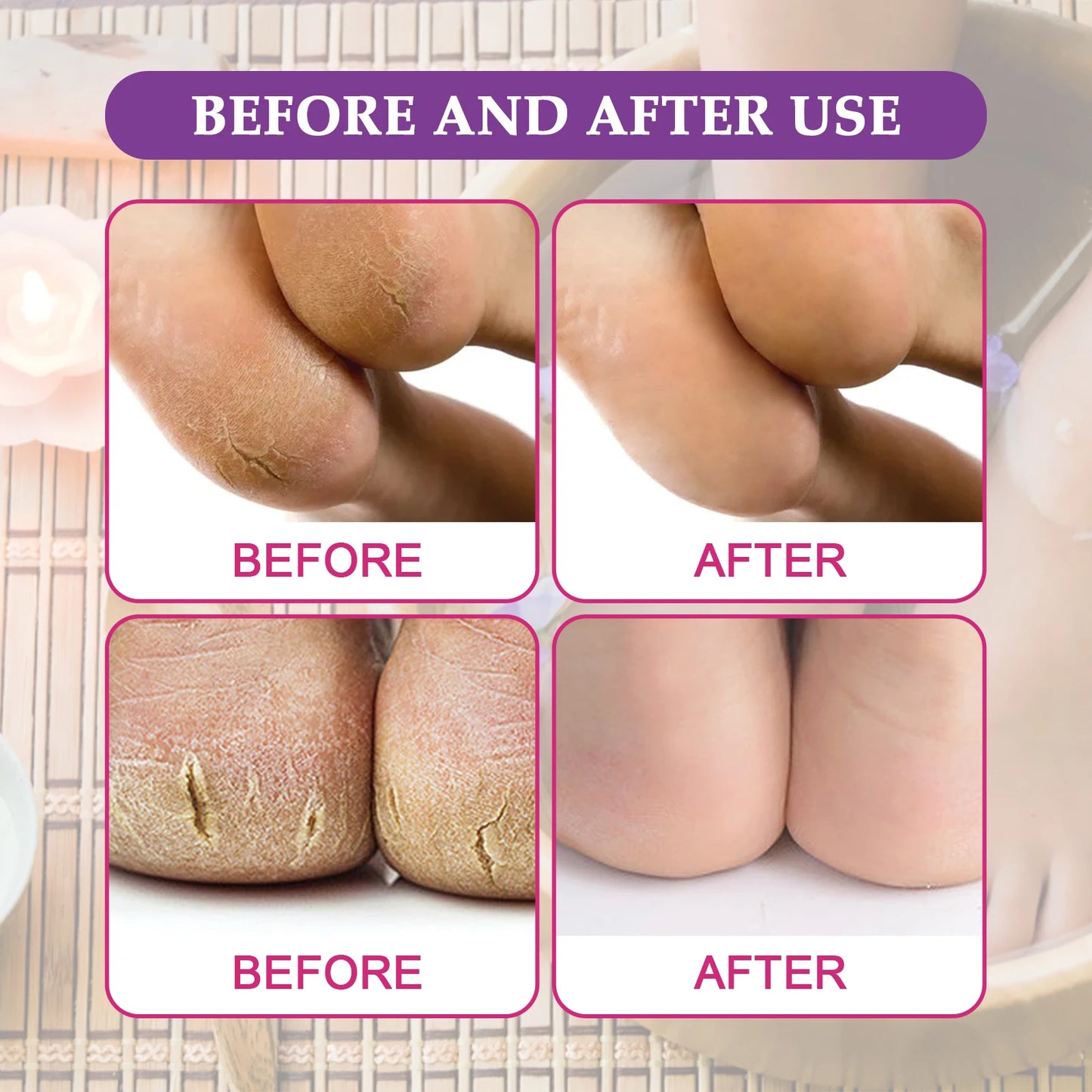 Green Tea Sea Salt Foot Soak – Exfoliate & Soften Feet