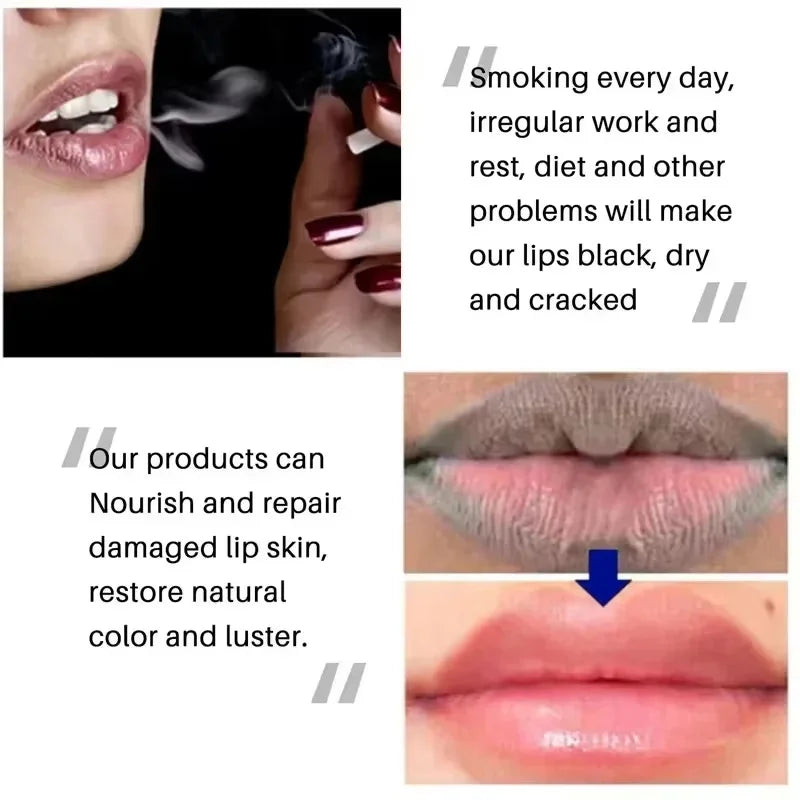 Eelhoe Lip Brightening Balm – Exfoliate, Nourish & Restore