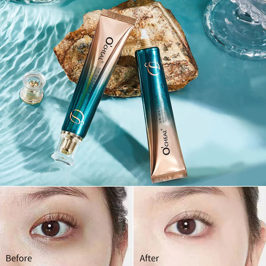 Retinol A Ester Elastic Moisturizing Firming Eye Cream Fading Fine Lines Dark Circles 30g Peaceful Pleasures Health and Wellness