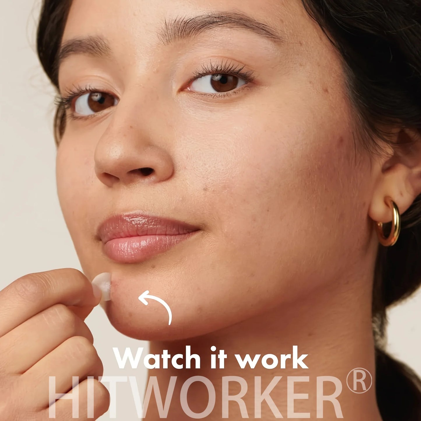 Hydrocolloid Acne Patches – Invisible, Waterproof | All Skin Types