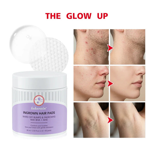Ingrown Hair Exfoliating Pads | Aftershave Treatment 60 Pads Aftershave Exfoliating Pads Oasis Select Default Title