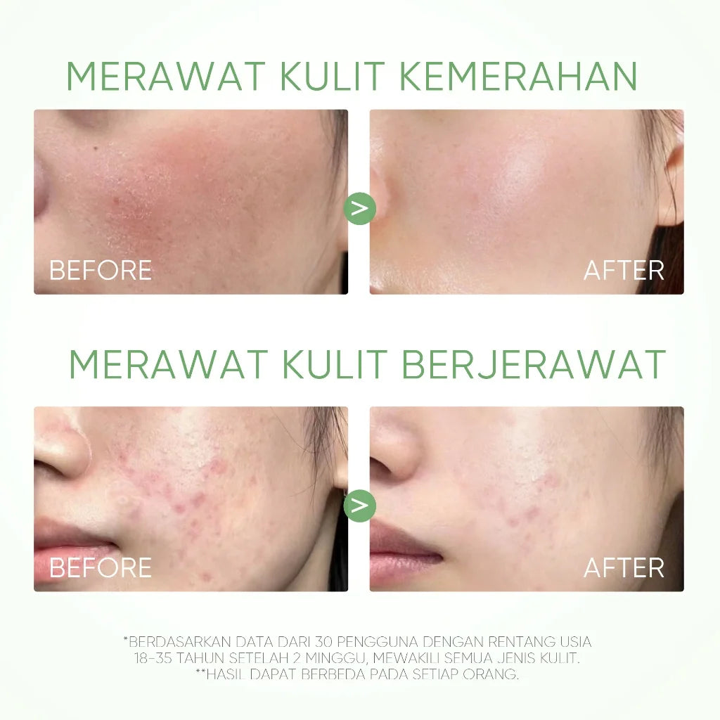 Mugwort Clay Stick Anti-Acne Clay Mask for Clean Pores and Blackheads Improve Acne Prone Skin 40g Peaceful Pleasures Health and Wellness