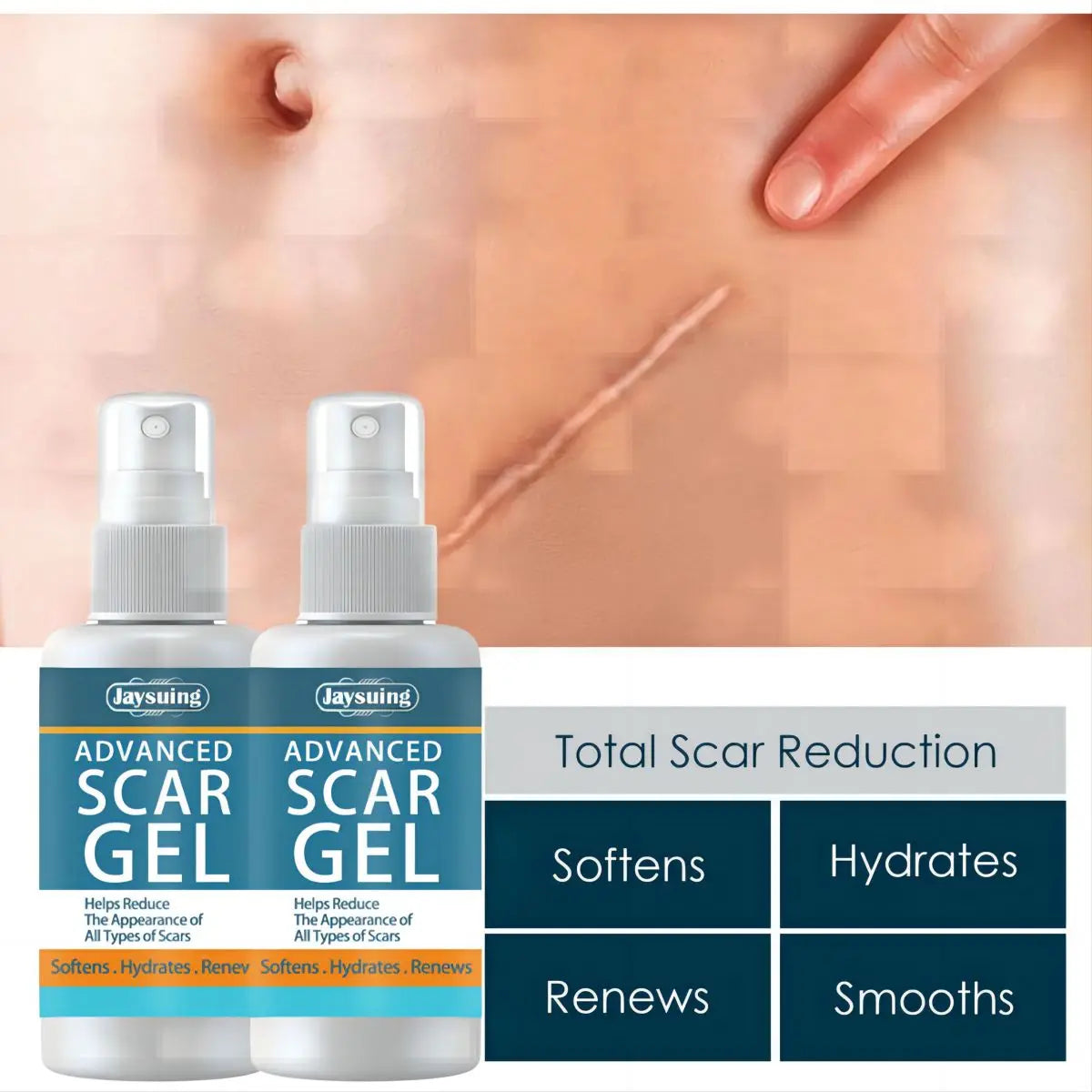 Scar Fade Cream Gel – Stretch Marks & Skin Smoothing