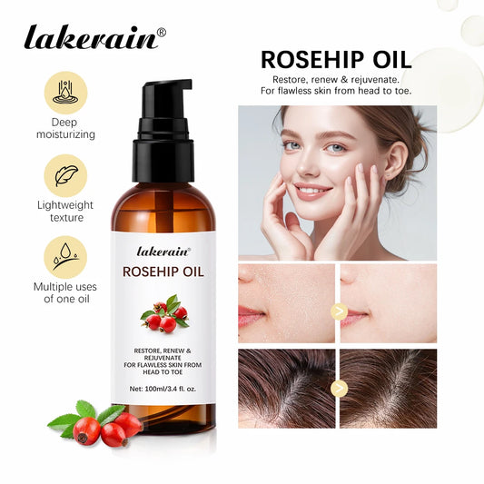 Organic Rosehip Oil Rose Hips Face Oils 30ml Fast-Absorbing Skin Care Moisturizer Face Oil Organic Rosehip Seed Oil Essence Peaceful Pleasures Health and Wellness