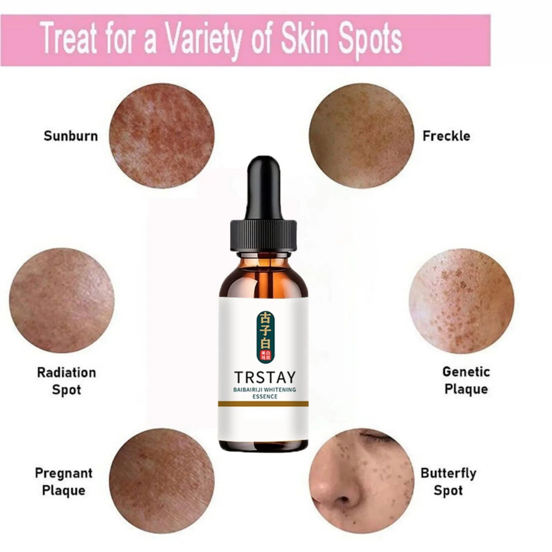 Effective Whitening Serum Remove Dark Spots Freckle Essence Anti-Aging Fade Pigmentation Melasma Brighten Beauty Face Skin Care Peaceful Pleasures Health and Wellness