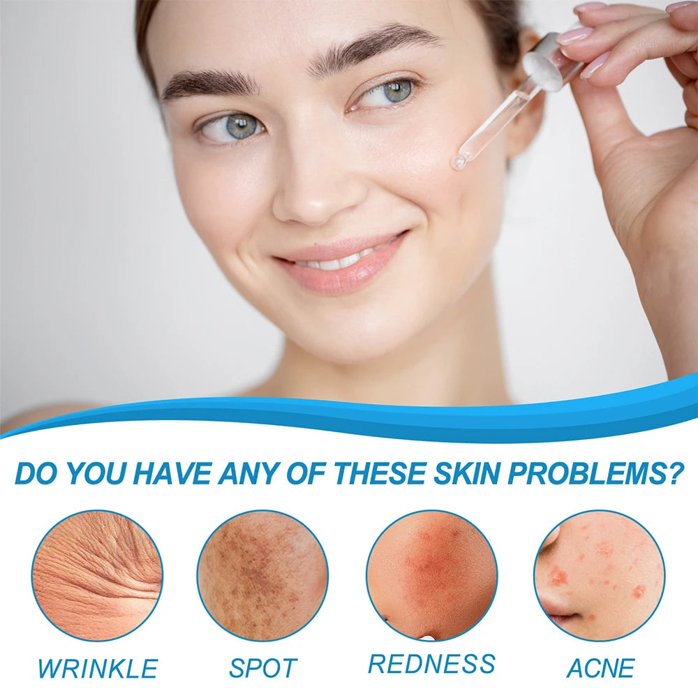 YOUNGCOME HYALU B5 Serum Anti -Wrinkle Collagen Instant Face Tightening Fade Fine Lines Hydrating for Plumping Peaceful Pleasures Health and Wellness