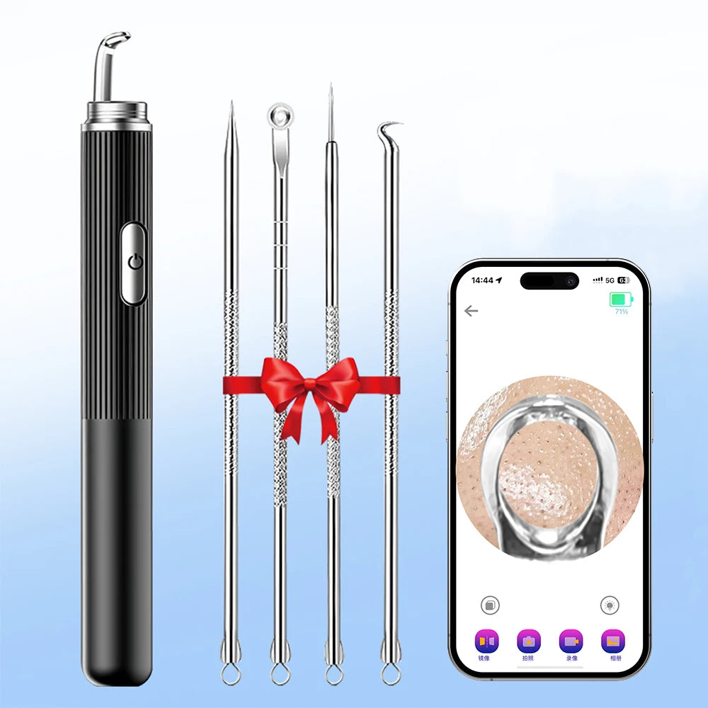 Visual Blackhead Remover with Camera Pimple Popper Extractor Tool Pore Cleaner Kit for Acne Comedone Whitehead Black Dots Remove Peaceful Pleasures Health and Wellness