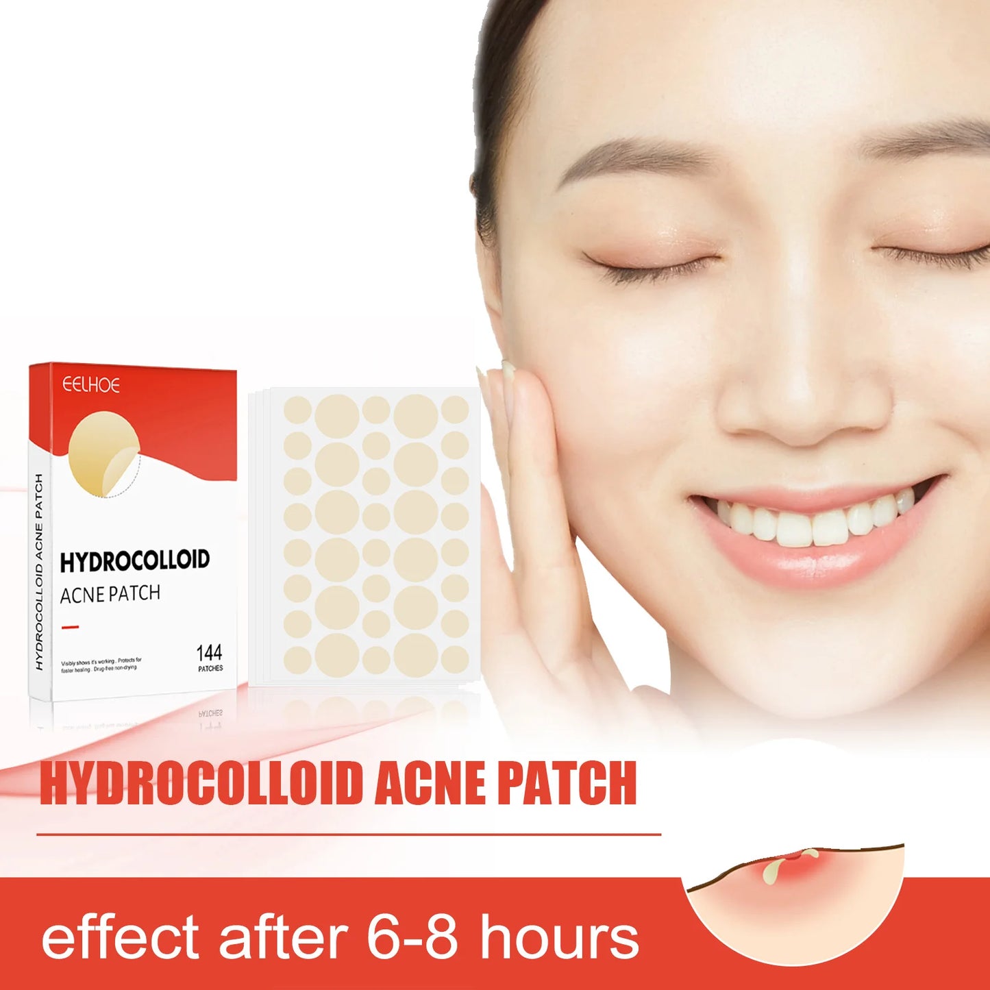 Hydrocolloid Acne Patches 144pcs – 2 Sizes, Invisible Pimple Patch