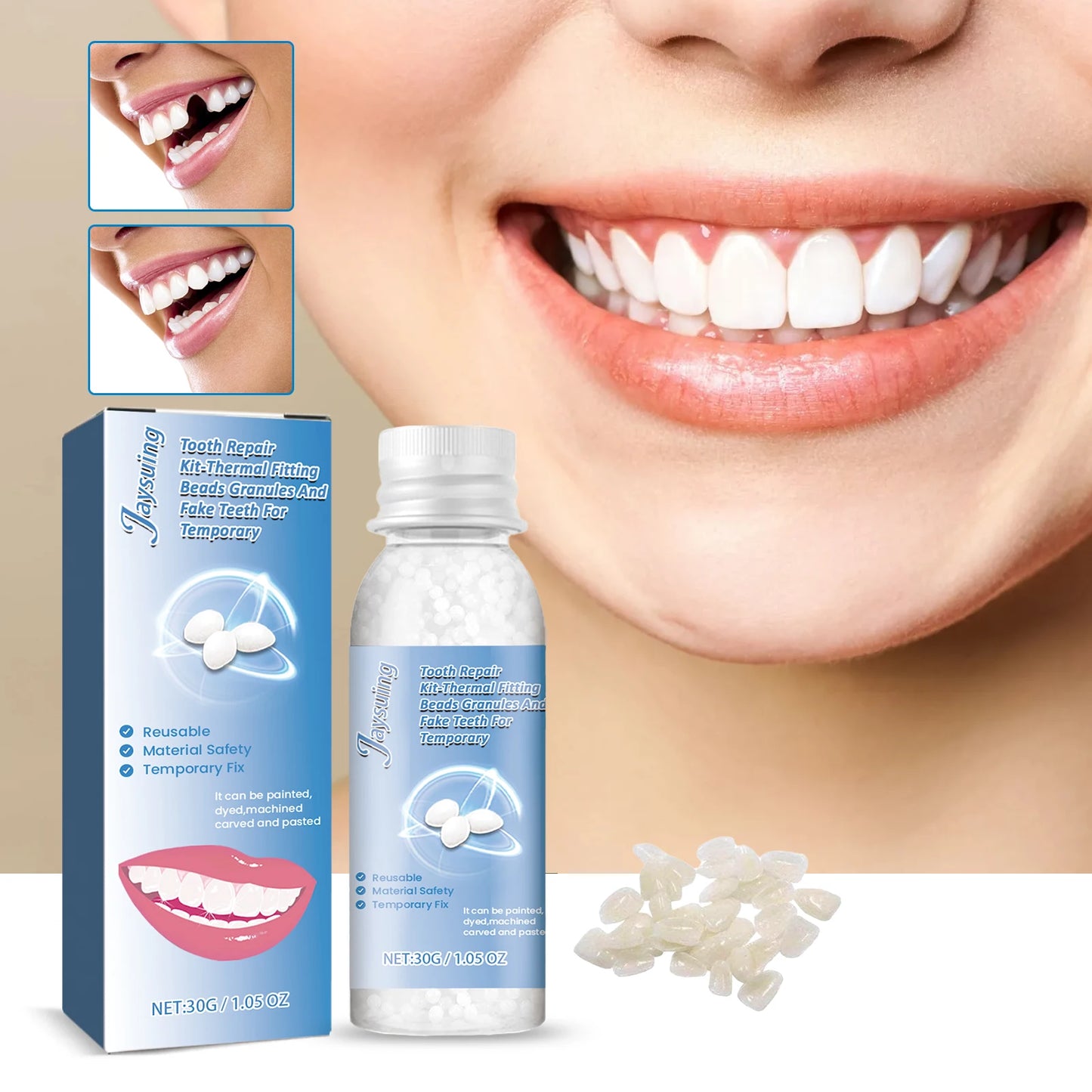 Jaysuing 30g Moldable Temporary Tooth Repair Gel Kit