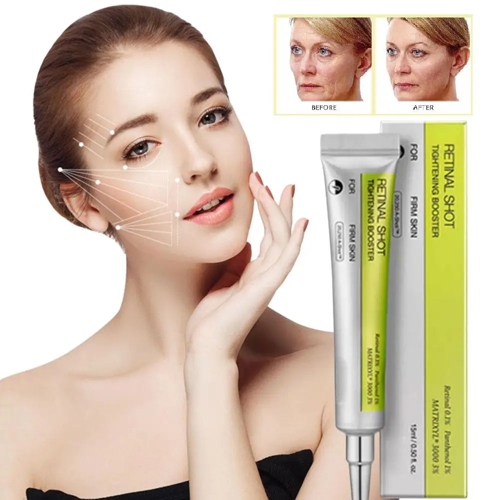 Retinol Eye Cream – Firming, Brightening & Moisturizing 15ml
