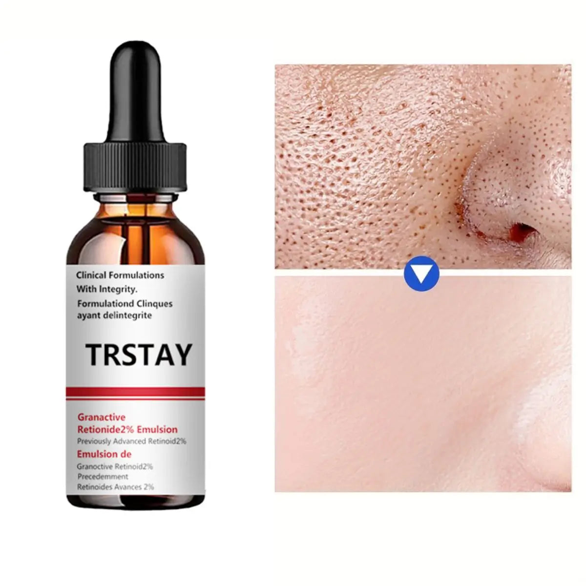Pore Minimizer Serum For Face Facial Pore Narrowing Serum Pore Contraction Tightens Essence Shrink Pores Tight lifting Serum Peaceful Pleasures Health and Wellness 15ml