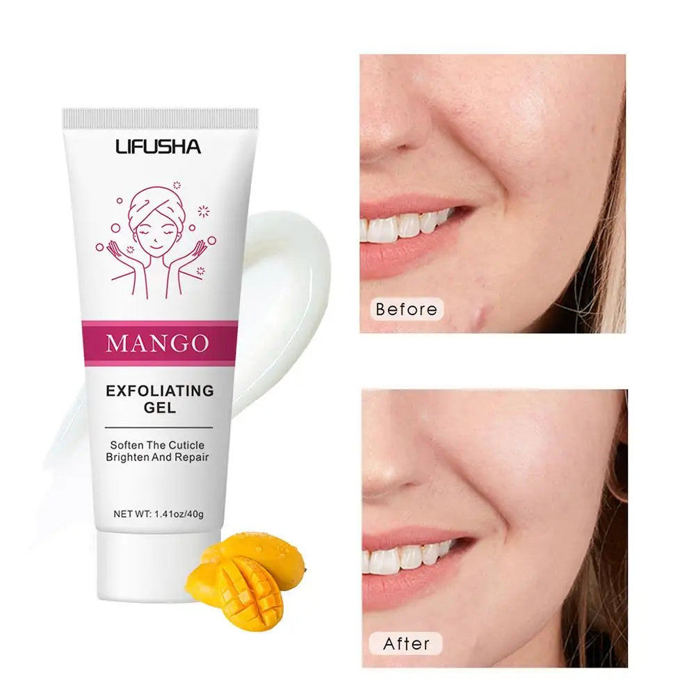 40g/50g Face Exfoliating Gel Deep Cleaning Pores Gentle Exfoliate Oil Control Smooth Soften Face Facial Scrub Skin Moisturizing Peaceful Pleasures Health and Wellness