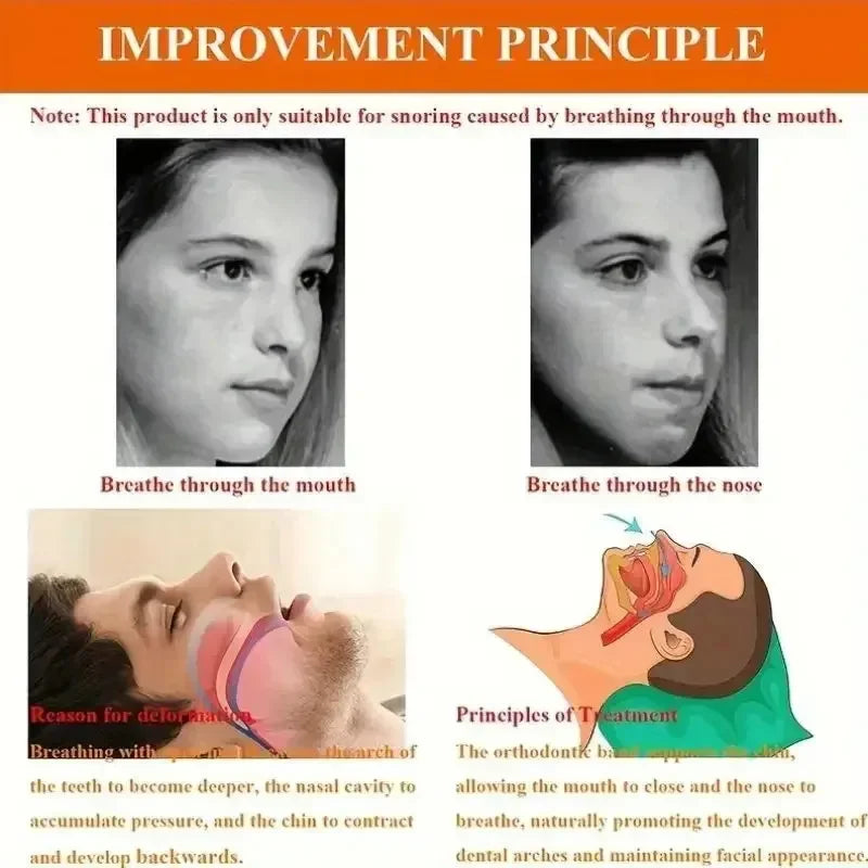 Anti-snoring Band Open Mouth Breathing Corrective Anti-snoring Chin Rest Sleep Open Mouth Rest Peaceful Pleasures Health and Wellness