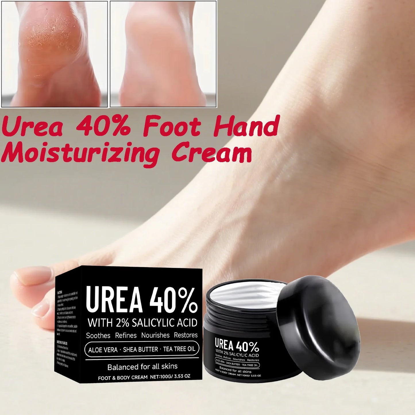 Urea 40% Foot & Hand Cream – Deep Moisturizer for Dry Skin