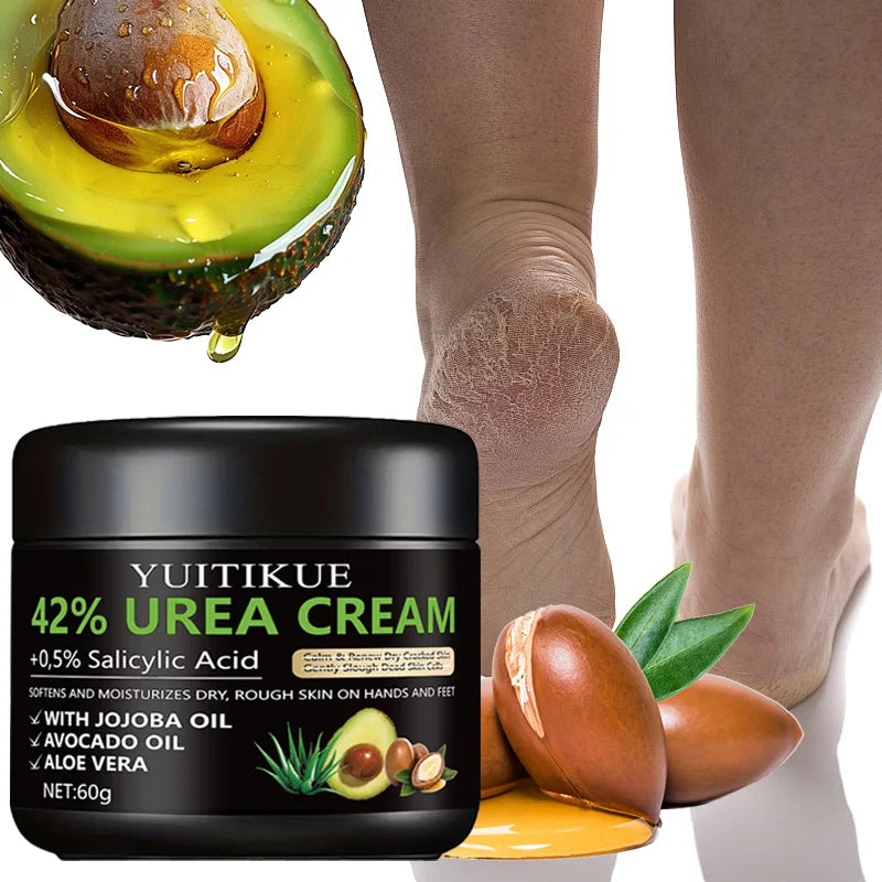 Intensive Foot Cream 60g - 42% Urea Formula for Extremely Dry Skin Softens Moisturizes Rough Areas on Hands & Feet Peaceful Pleasures Health and Wellness