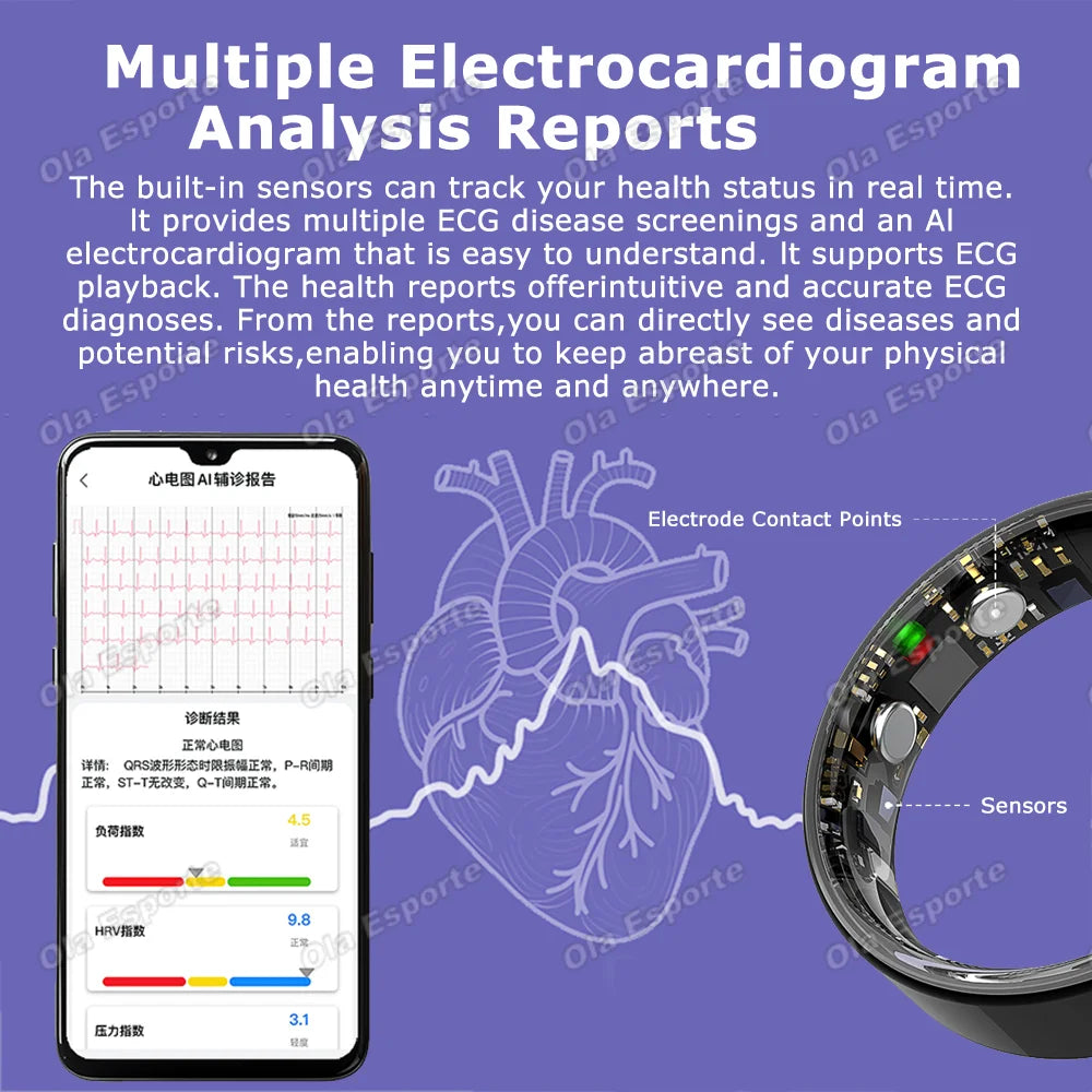 AI ECG Smart Ring – Heart Rate, Blood Pressure & Sleep Tracker