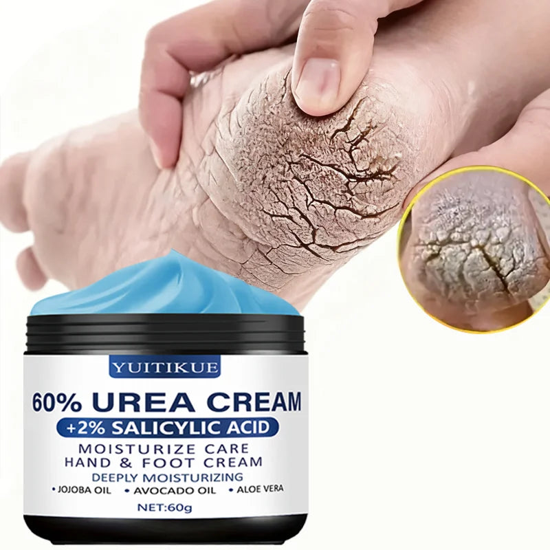 Urea Cream 60g - for Hands & Feet, Deeply Moisturizes & Softens Skin, Fast Absorption, Non-Greasy, All Skin Types Peaceful Pleasures Health and Wellness