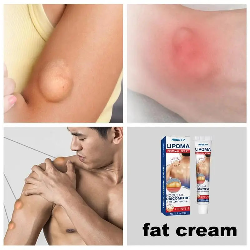 Herbal Skin Smoothing Cream – Fat Bulge & Lump Care 20g