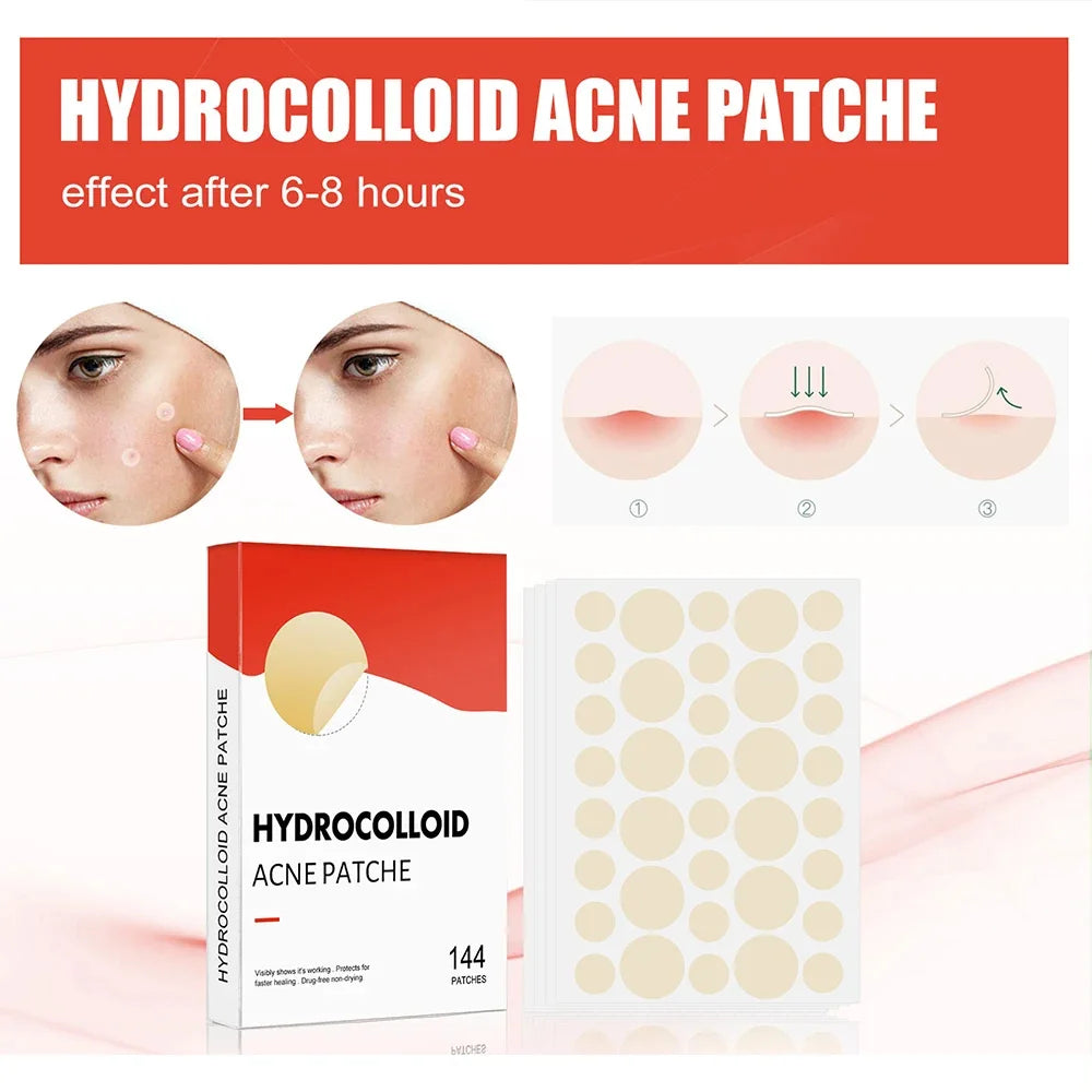 280/144pcs Face Acne Patch Invisible Skin Care Pimple Acne Patche Anti-inflammatory Healing Absorbing Spot Sticker Covering Acne Peaceful Pleasures Health and Wellness