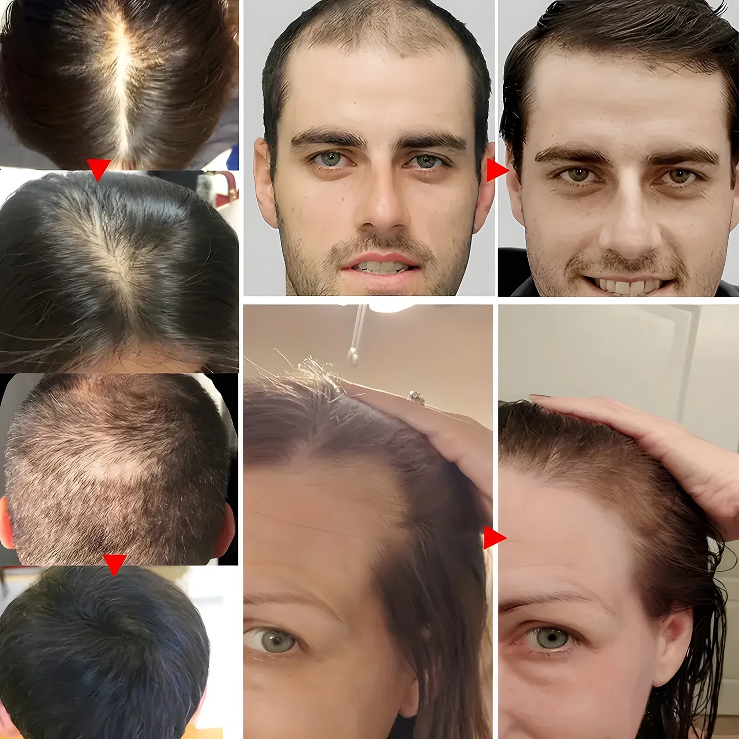 Moroccan hair oil, plant extracts used for hair repair and care, addressing frizz, tangles, and other issues. Peaceful Pleasures Health and Wellness