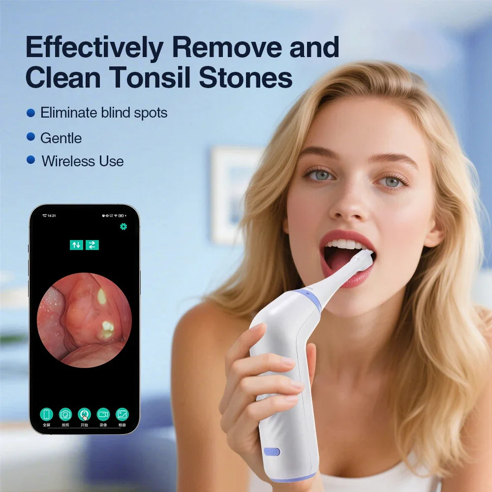 Electric Tonsil Stone Remover – 300K HD Camera & LED Light