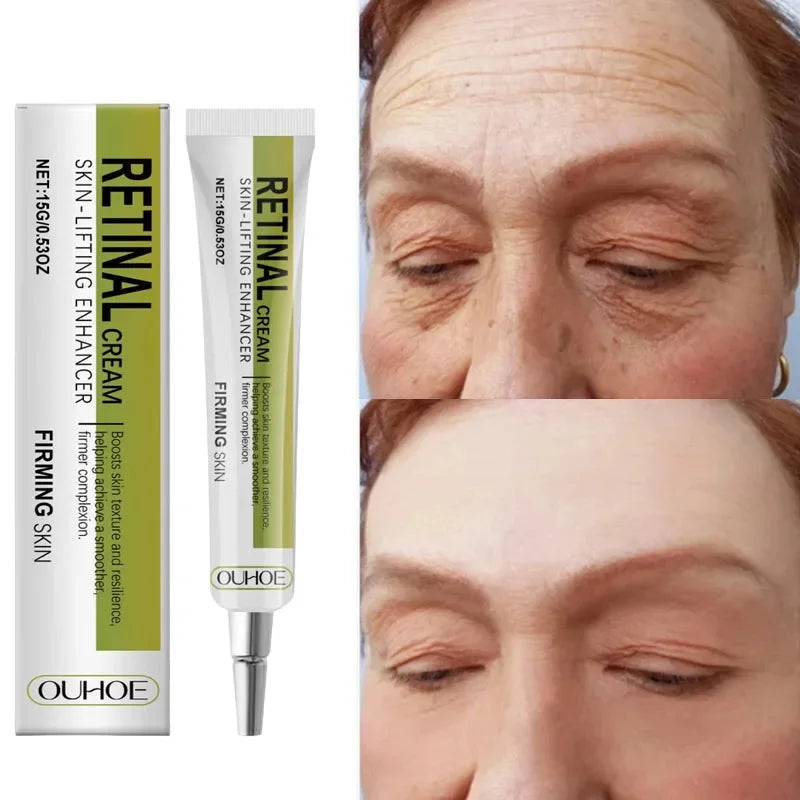 Retinol Face Cream – Firming, Anti-Aging & Moisturizing
