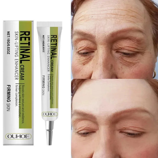 Retinol Face Cream – Firming, Anti-Aging & Moisturizing Retinol Face Cream Oasis Select