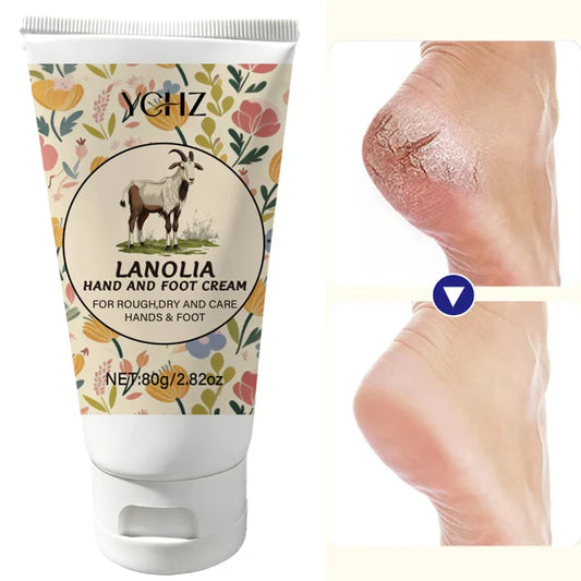 YCHZ Foot Cream – Moisturizer for Dry, Rough & Cracked Heels Foot Cream Oasis Select