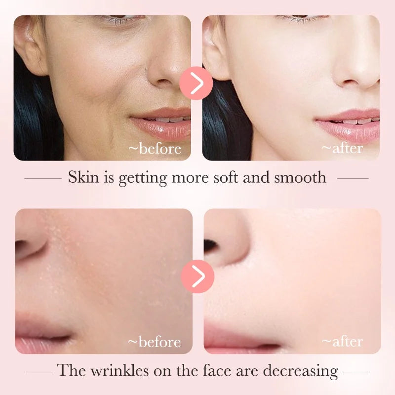 BIOAQUA Niacinamide Serum for Reducing Dark Spots Whitening and Moisturizing Brightening Skin Tone 30ml Peaceful Pleasures Health and Wellness