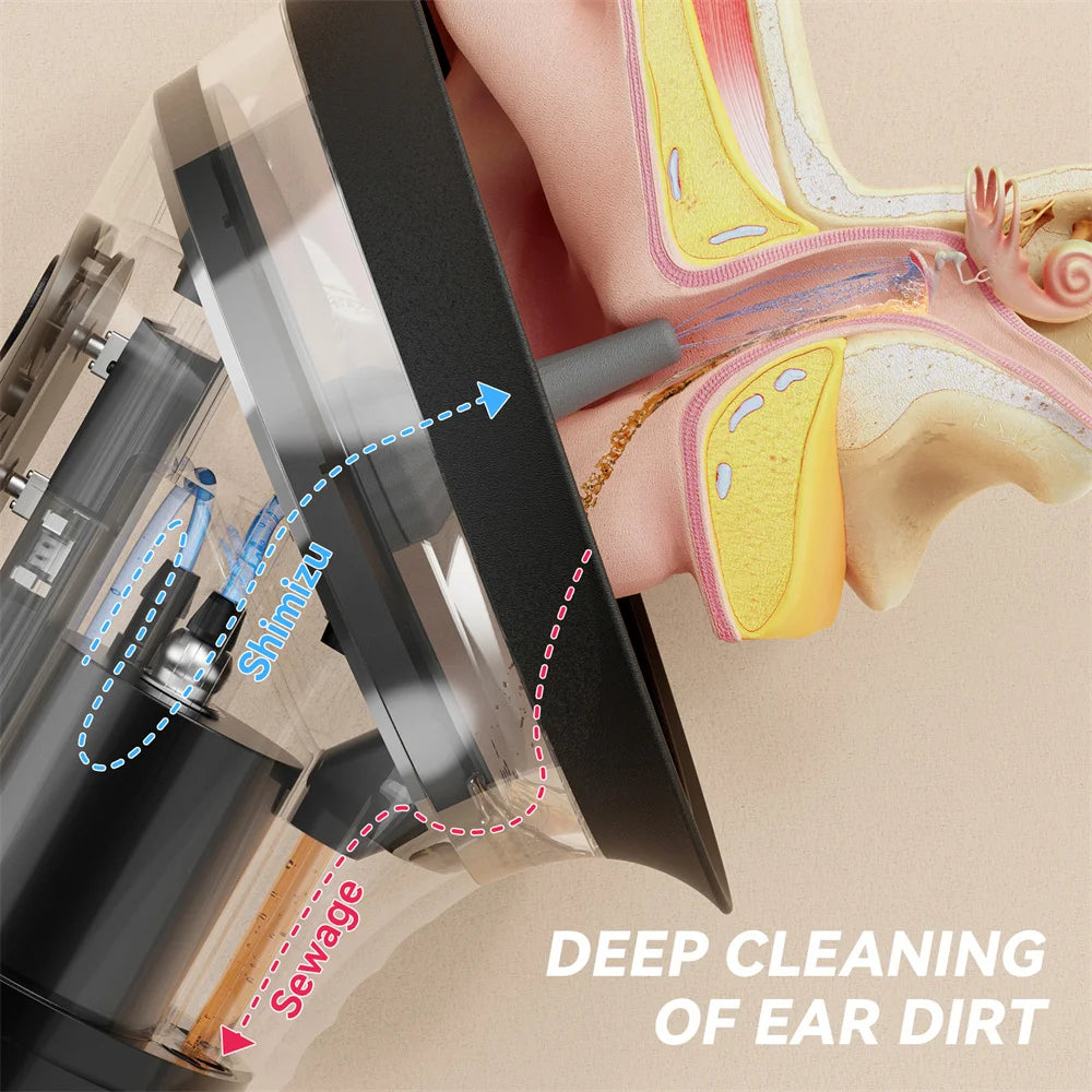 Electric Ear Wax Removal System Water Powered Ear Cleaning Tool with Irrigation Flusher 3 Pressure Settings Safe & Effective Peaceful Pleasures Health and Wellness