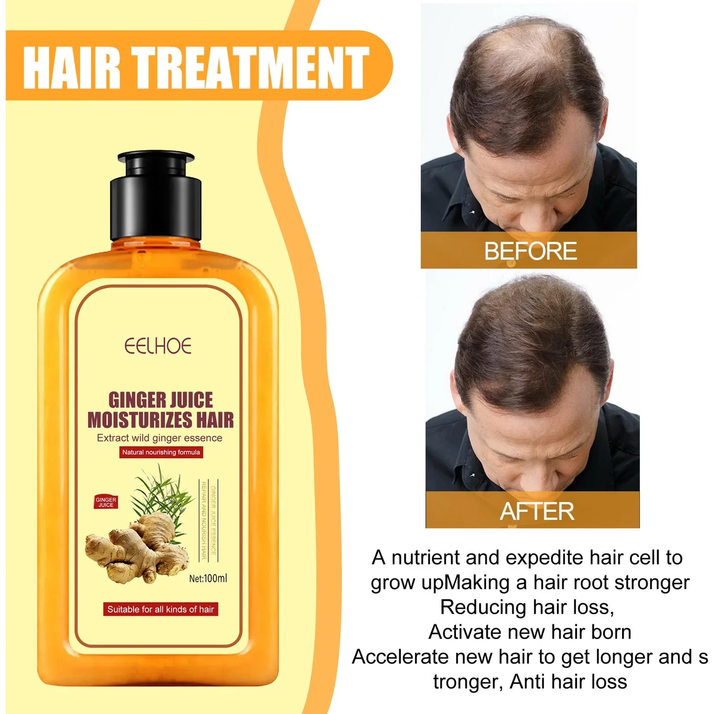 EELHOE Ginger Anti Hair Loss Shampoo – Strengthen & Repair