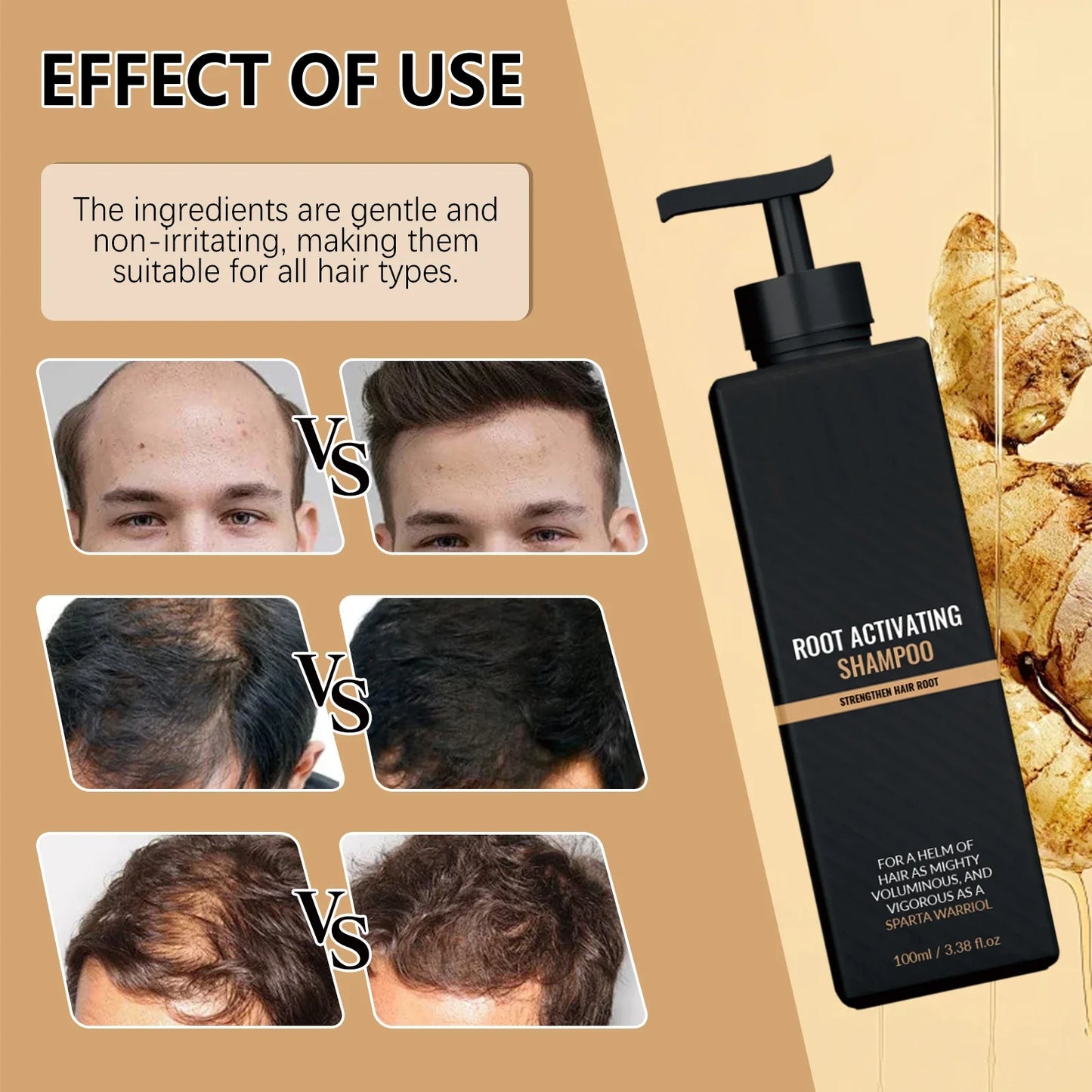 HOEGOA Ginger Volumizing Shampoo – Deep Cleansing & pH Balanced