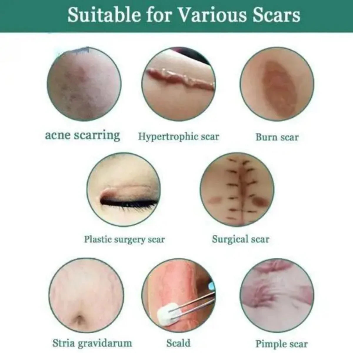 Scar Fade Cream Gel – Stretch Marks & Skin Smoothing