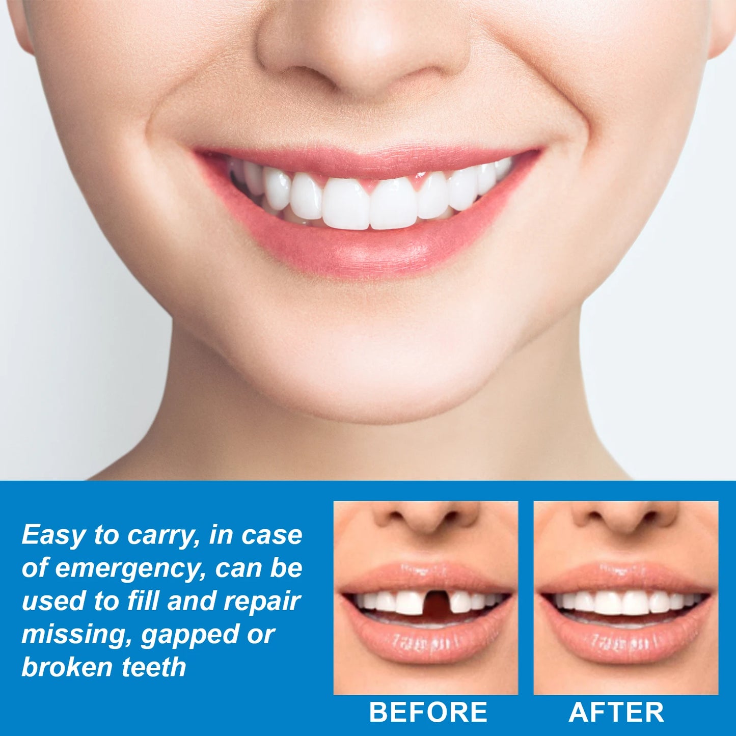 Temporary Tooth Repair Kit – DIY Dental Restoration Beads