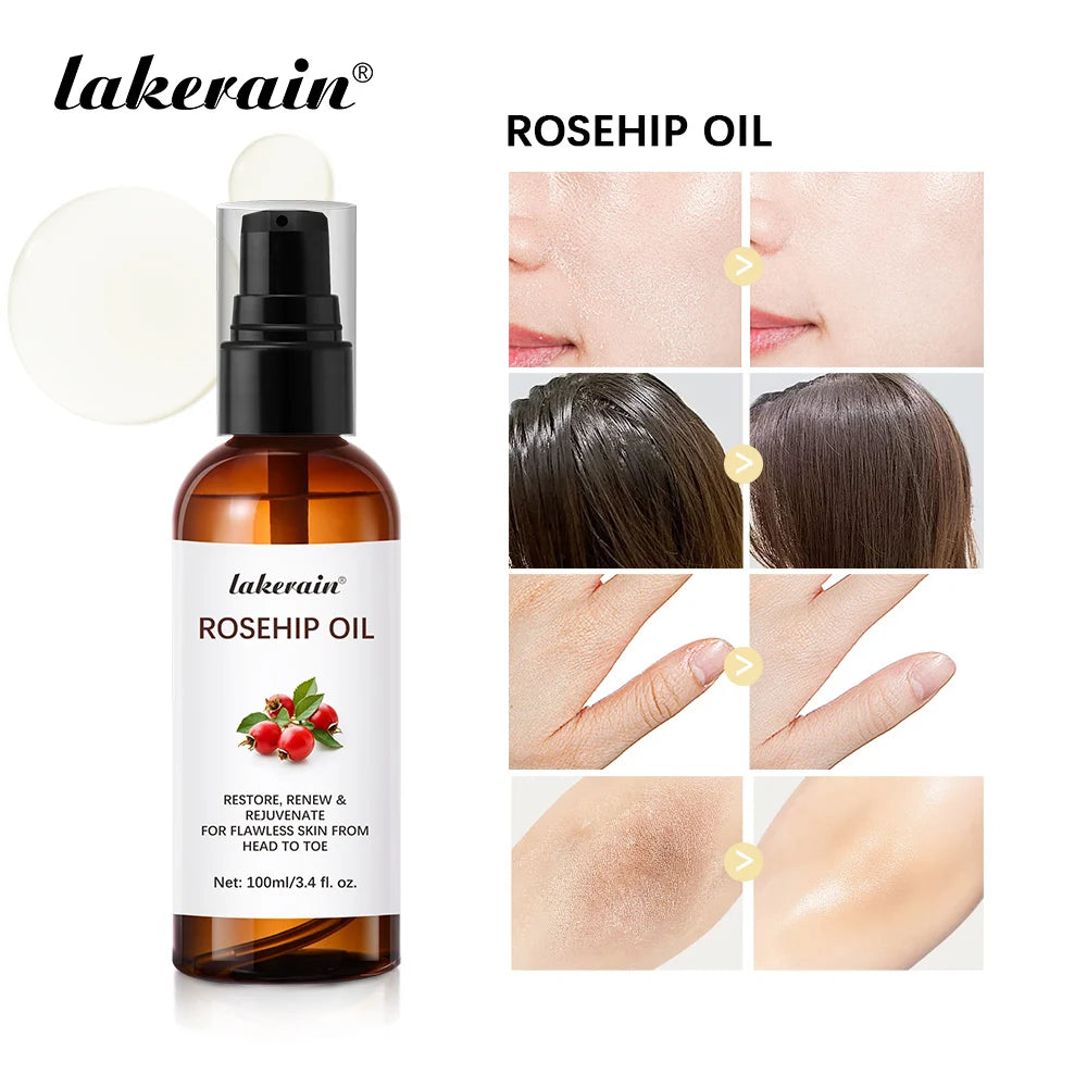 Organic Rosehip Oil Rose Hips Face Oils 30ml Fast-Absorbing Skin Care Moisturizer Face Oil Organic Rosehip Seed Oil Essence Peaceful Pleasures Health and Wellness 100ml