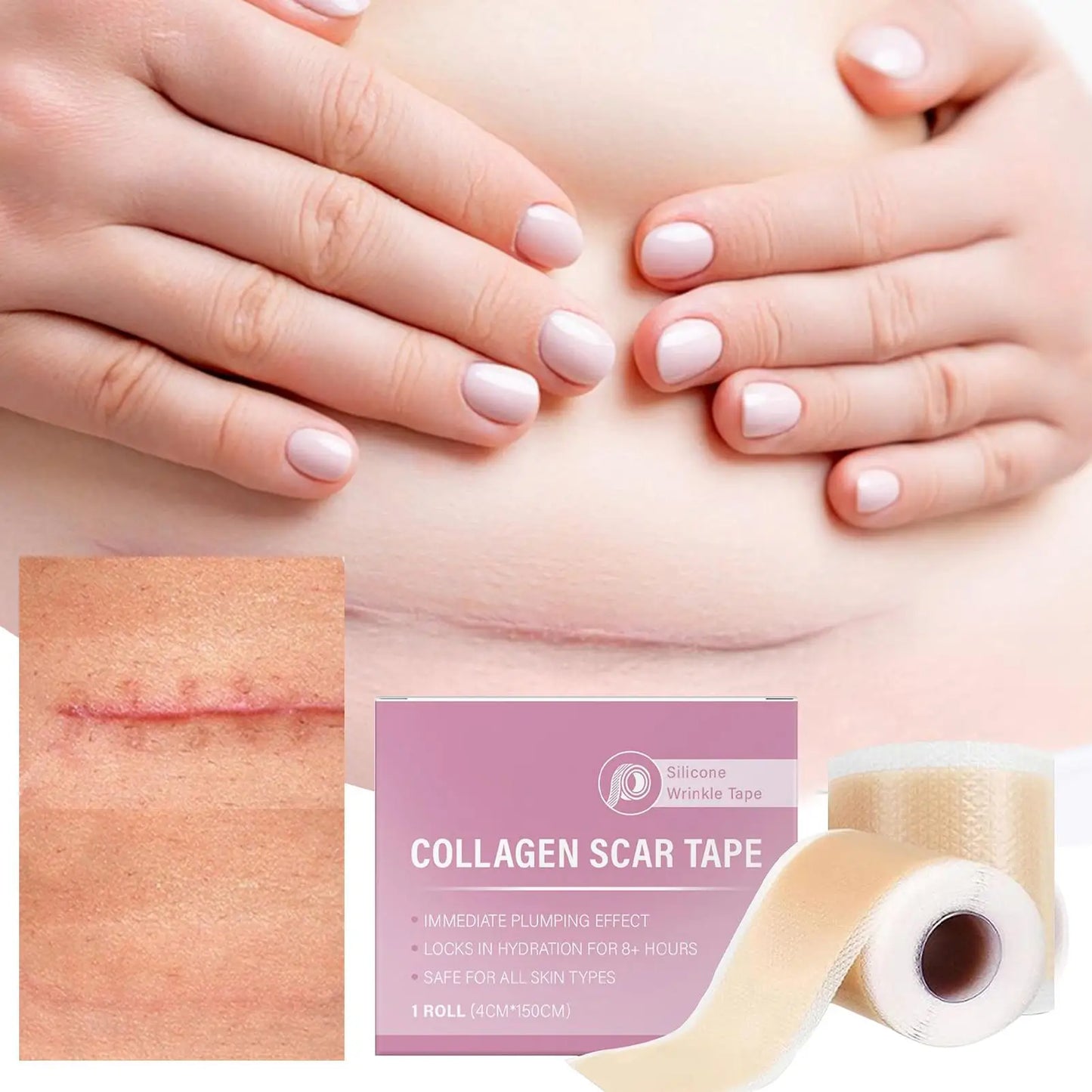 Scar Sheets 1 Roll Self-Adhesive Scar Cover Tape Skin Care Waterproof and Breathable Peaceful Pleasures Health and Wellness