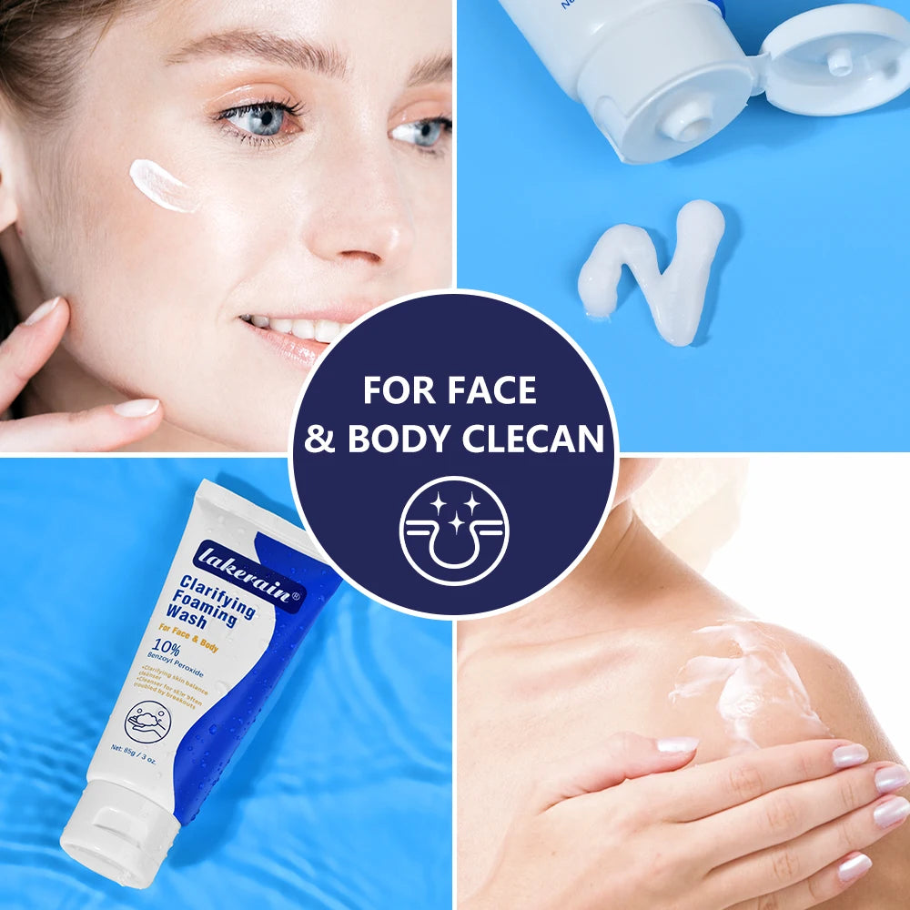 Acne Foaming Wash Benzoyl Peroxide 10% Maximum Antimicrobia Moisturizers reduces redness For Face & Body Skin Care Face Wash Peaceful Pleasures Health and Wellness