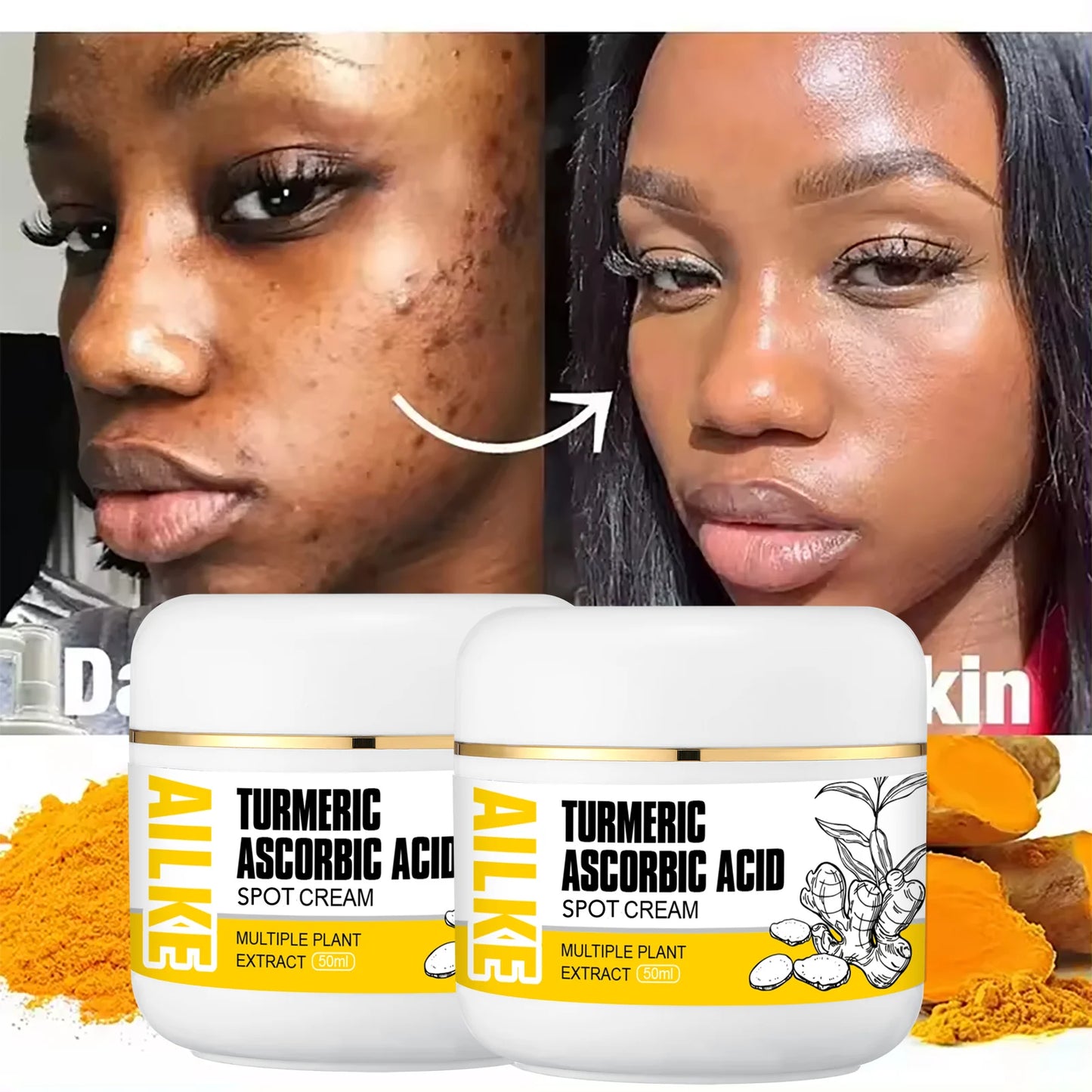 AILKE Turmeric Brightening Face Cream | Glow & Clear Skin 50ml